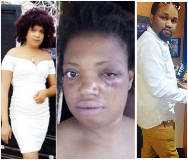 Nigerian lady battered by her brother in-law  %Post Title