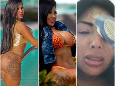 Instagram model blinded after surgery to change eye colour goes wrong (photos)  %Post Title