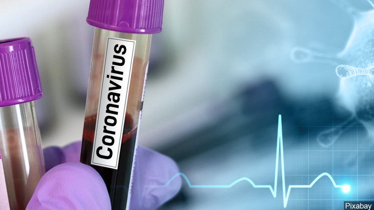 FAKE NEWS ALERT: 45m Nigerians to die of coronavirus? Verifying claims in viral WhatsApp audio  %Post Title