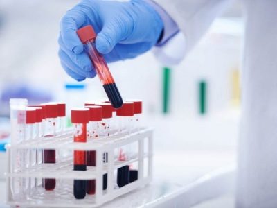 UK begins world’s largest trial of blood test that can detect over 50 types of cancer  %Post Title